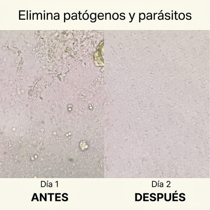 Vientre plano – Apoyo para el colon | Elimina parásitos, limpia tu intestino y siéntete más ligero