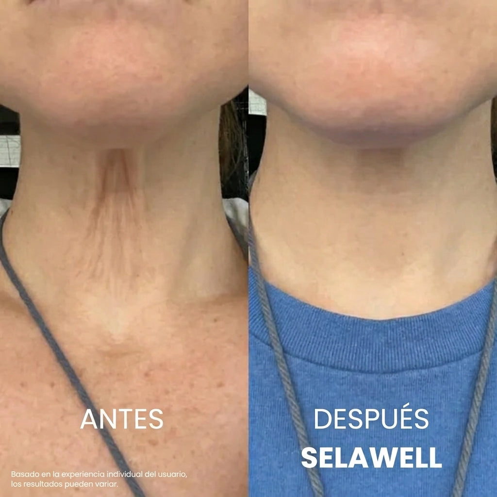 Selawell® | Crema para Cuello - Reafirma y Eleva